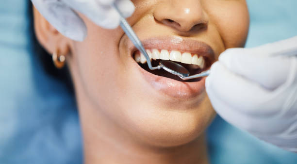 Best Emergency Treatment for Dental Infections or Abscesses in Ashland, CA