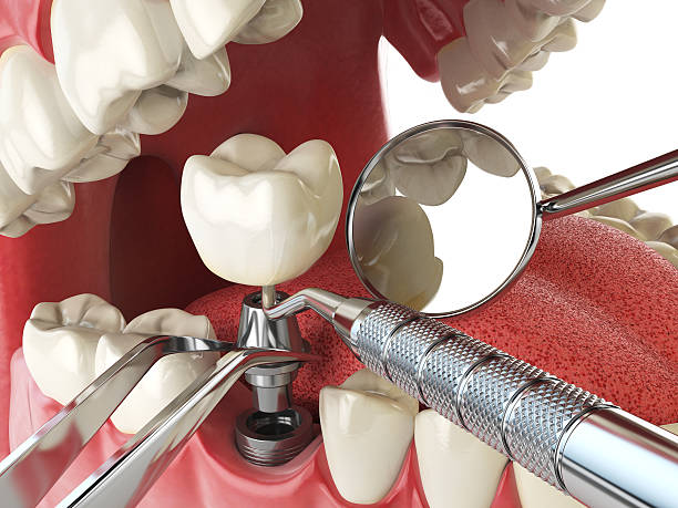 Best Emergency TMJ Treatment in Ashland, CA
